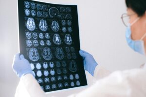 Badania radiologiczne – na czym polegają, rodzaje i przygotowanie do diagnostyki