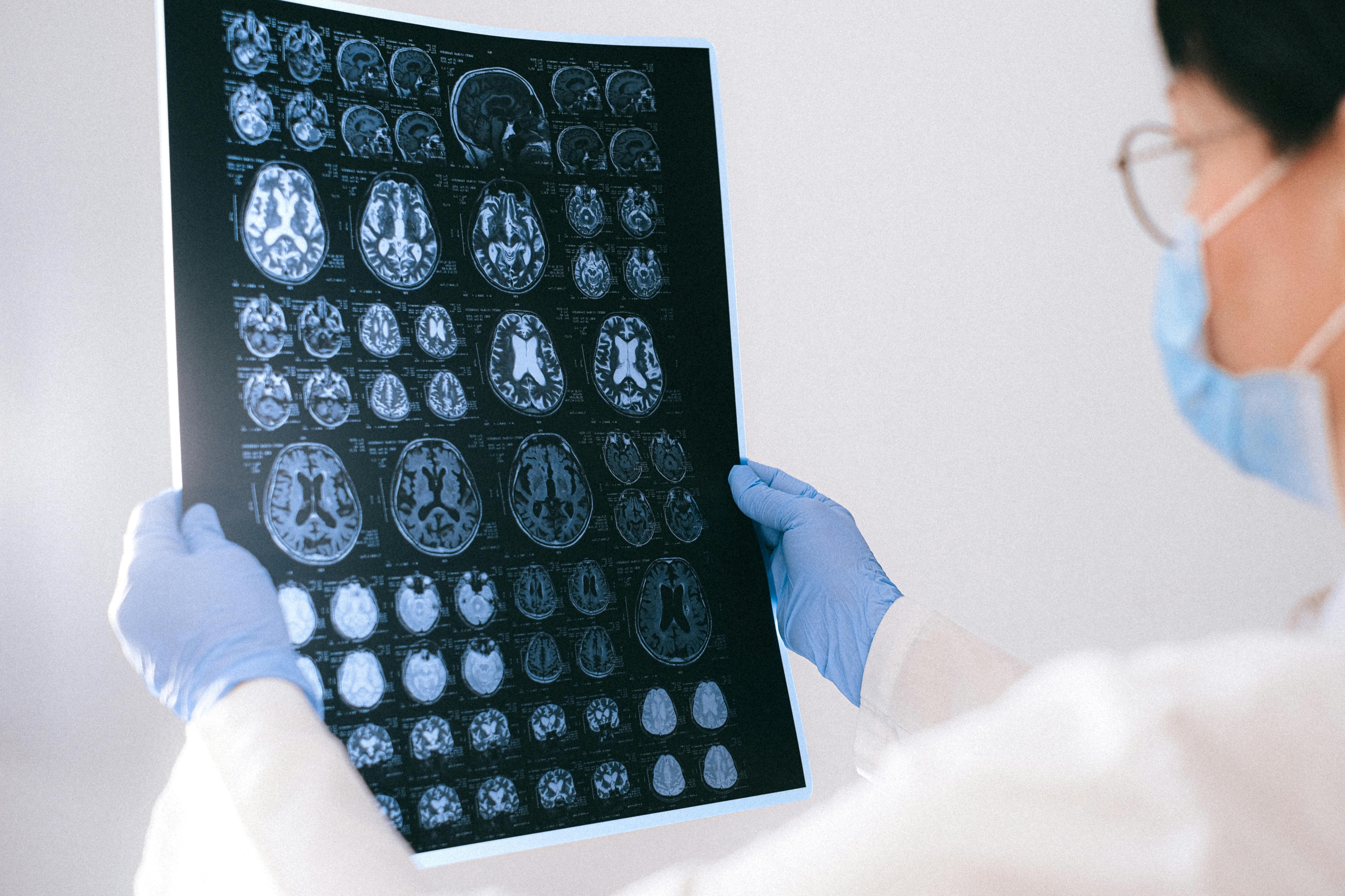 Badania radiologiczne – na czym polegają, rodzaje i przygotowanie do diagnostyki