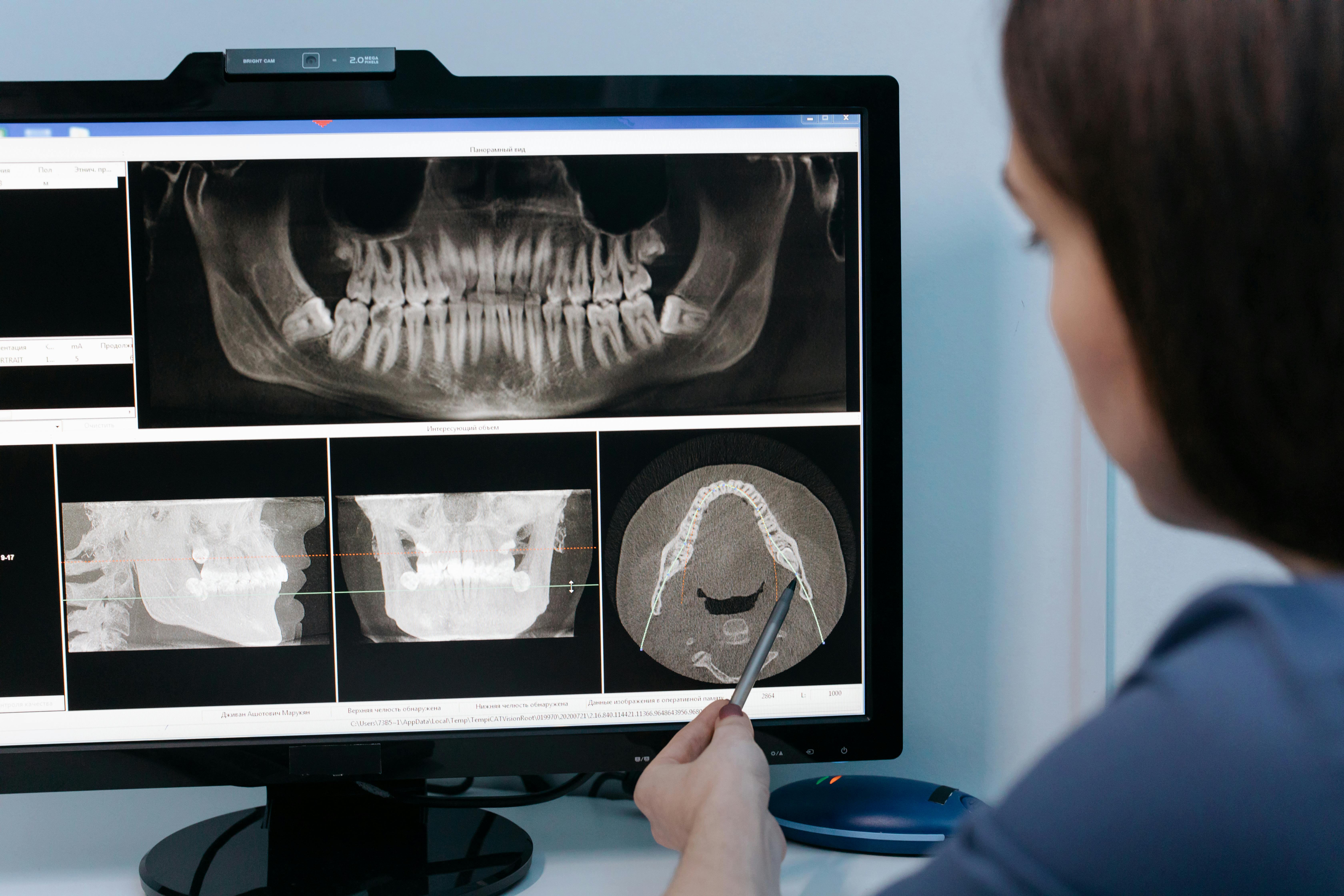 Kto opisuje zdjęcia RTG i jak wygląda proces opisu radiologicznego