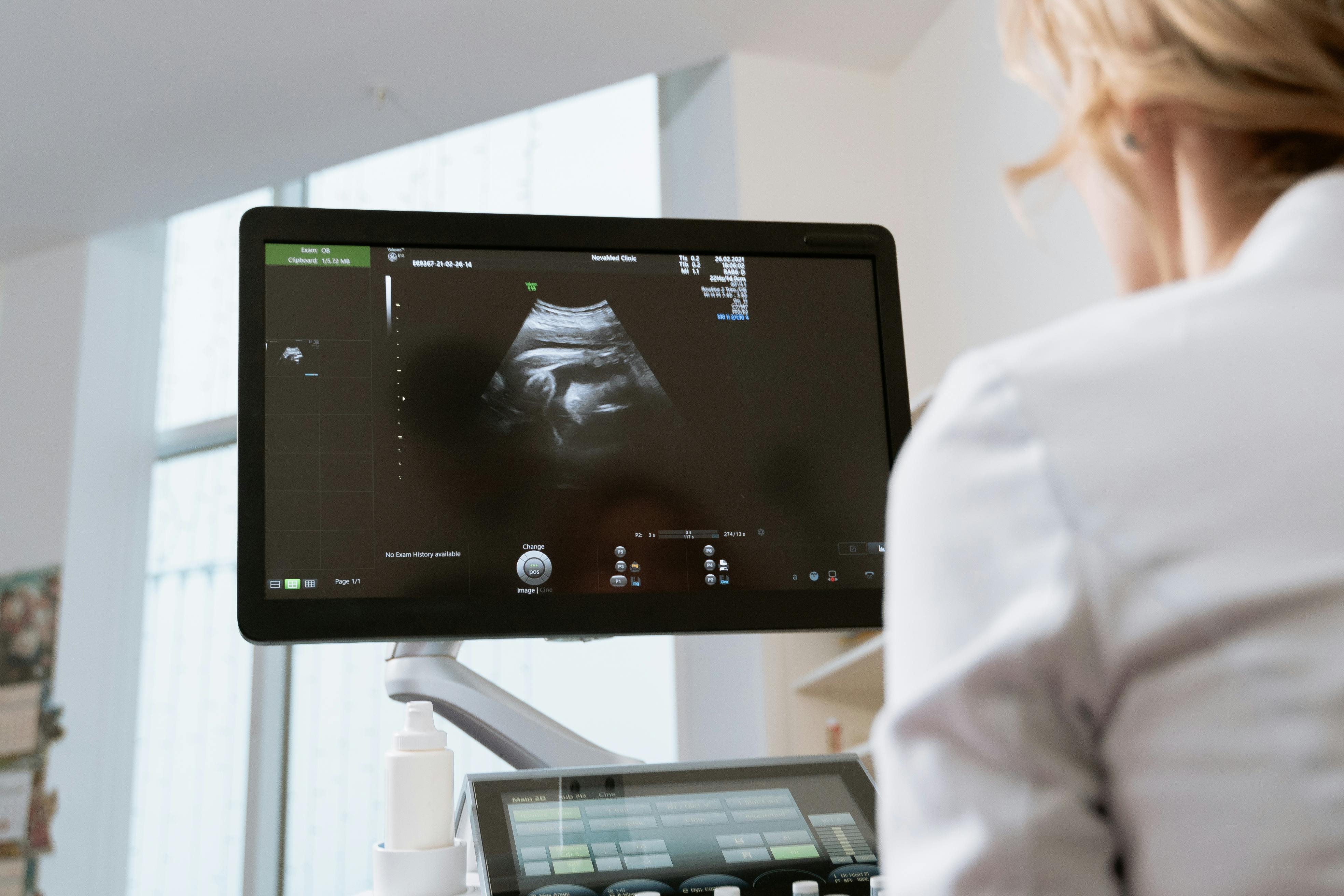 Przykładowy opis tomografii komputerowej – jak wygląda badanie krok po kroku