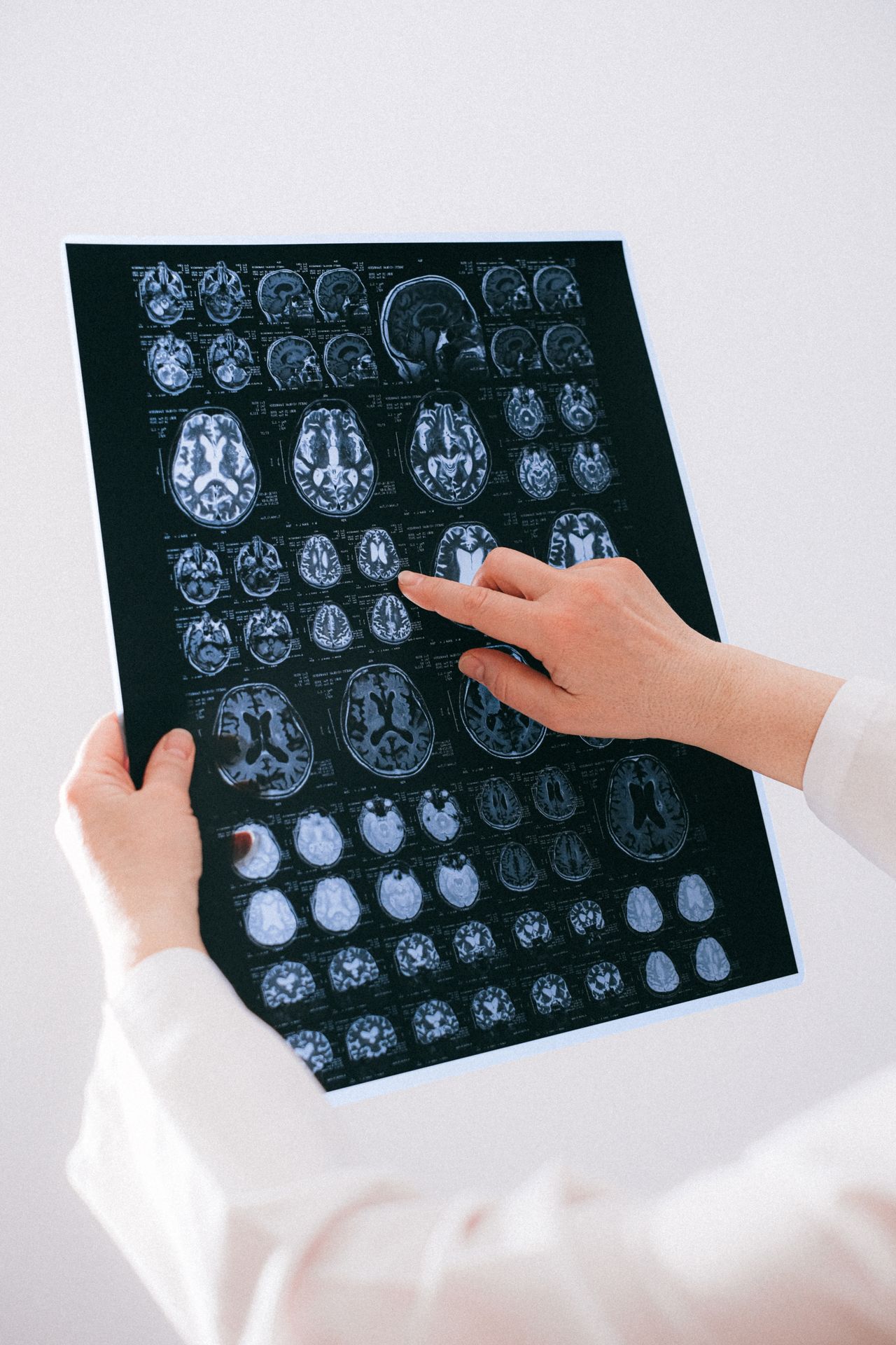 Co jest dokładniejsze: tomografia komputerowa czy rezonans magnetyczny? Porównanie metod diagnostycznych