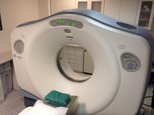 Tomografia jamy brzusznej – na czym polega badanie, wskazania i przygotowanie
